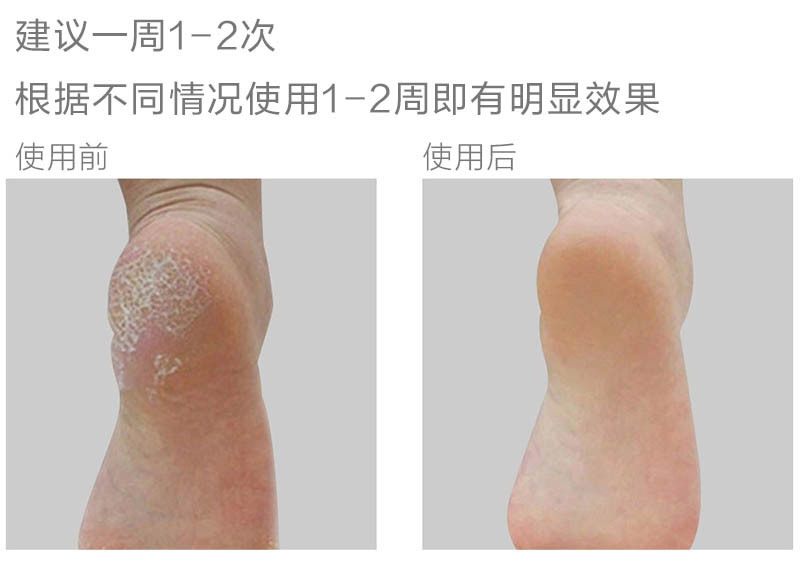 韩国原产magicare粗砂去死皮磨脚石搓脚板脚锉木柄1个装 黑色